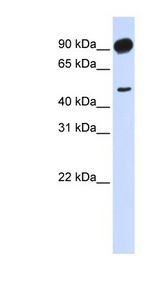 ADD2 antibody LS-C102423 Western blot of Transfected 293T cell lysate.