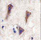 Formalin-fixed and paraffin-embedded human brain tissue reacted with CDH12 antibody , which was peroxidase-conjugated to the secondary antibody, followed by DAB staining. This data demonstrates the use of this antibody for immunohistochemistry; clinical relevance has not been evaluated.