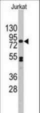 Western blot of anti-CDH12 Antibody (RB13742) in Jurkat cell line lysates (35 ug/lane). CDH12(arrow) was detected using the purified antibody.