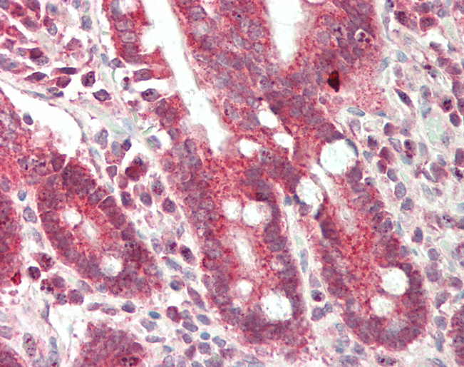 Human Small Intestine: Formalin-Fixed, Paraffin-Embedded (FFPE)
