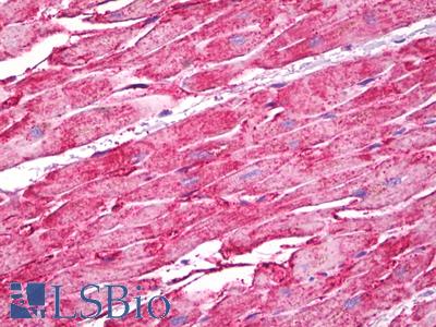 Anti-H Cadherin antibody IHC of human heart. Immunohistochemistry of formalin-fixed, paraffin-embedded tissue after heat-induced antigen retrieval. Antibody LS-B7119 concentration 5 ug/ml.