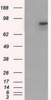 HEK293T cells were transfected with the pCMV6-ENTRY control (Left lane) or pCMV6-ENTRY CDH13 (Right lane) cDNA for 48 hrs and lysed. Equivalent amounts of cell lysates (5 ug per lane) were separated by SDS-PAGE and immunoblotted with anti-CDH13.