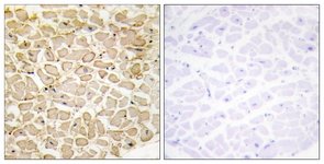 IHC of paraffin-embedded human heart tissue, using CDH13 Antibody. The picture on the right is treated with the synthesized peptide.