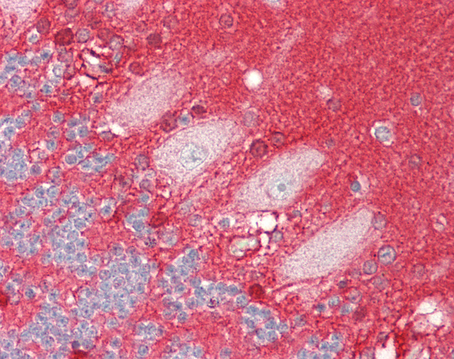 Human Brain, Cerebellum: Formalin-Fixed, Paraffin-Embedded (FFPE)
