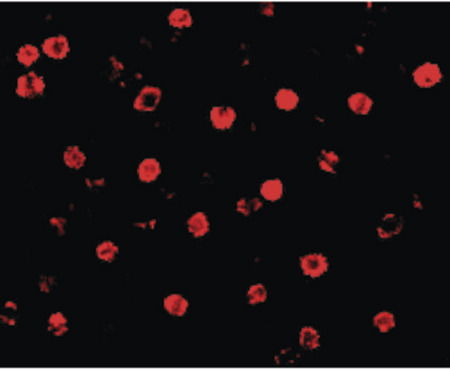 Immunofluorescence of T-cadherin in K562 cells with T-cadherin antibody at 20 ug/ml.