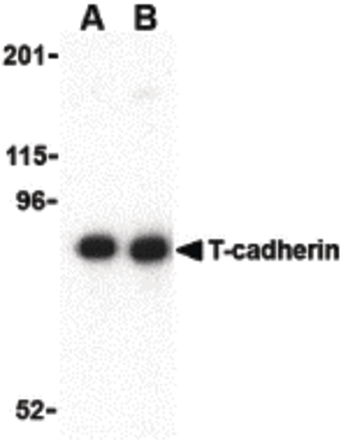 Western blot of T-cadherin in 3T3 lysate with T-cadherin antibody at (A) 0.5 and (B) 1 ug/ml.