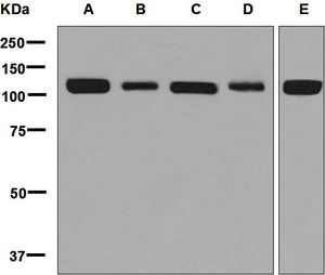 Western blot analysis on (A) A673, (B) human cerebellum, (C) fetal heart, (D) fetal brain, and (E) 293T cell lysates using anti-M Cadherin antibody.