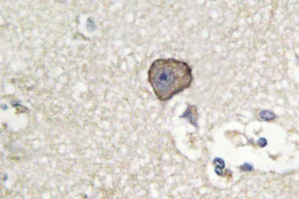 IHC of M-cadherin (A108) pAb in paraffin-embedded human brain tissue.