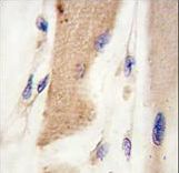 Formalin-fixed and paraffin-embedded human skeletal muscle tissue reacted with CDH15 antibody , which was peroxidase-conjugated to the secondary antibody, followed by DAB staining. This data demonstrates the use of this antibody for immunohistochemistry; clinical relevance has not been evaluated.