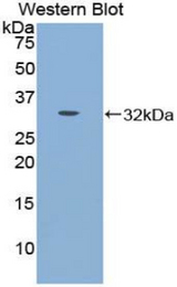 Western blot of recombinant CDH16 / Cadherin 16.