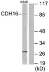 Western blot of extracts from A549 cells, using CDH16 Antibody. The lane on the right is treated with the synthesized peptide.