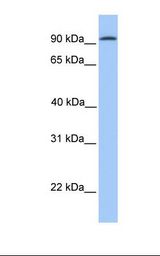Fetal brain lysate. Antibody concentration: 1.0 ug/ml. Gel concentration: 12%.