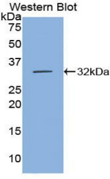 Western blot of recombinant CDH16 / Cadherin 16.