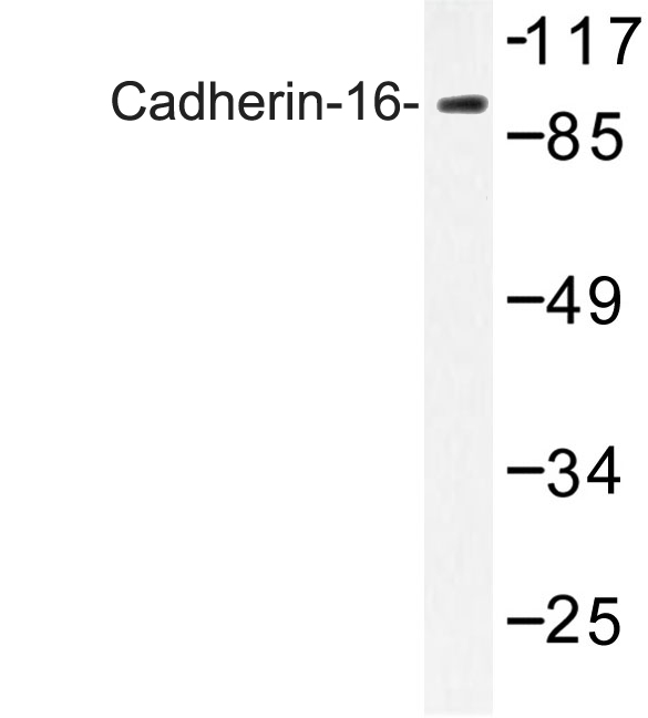 Western blot of Cadherin-16 (M810) pAb in extracts from A549 cells.