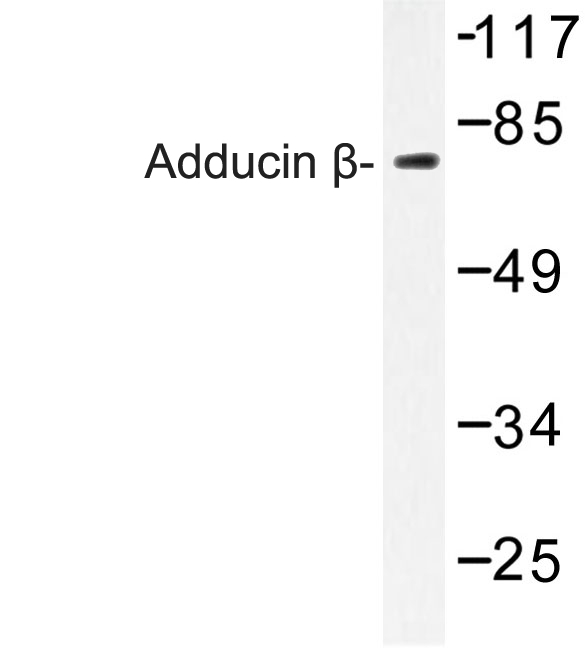 Western blot of Adducin (E497) pAb in extracts from 293 cells.