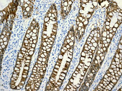 IHC of paraffin-embedded human colon tissue using anti-LI-Cadherin antibody.
