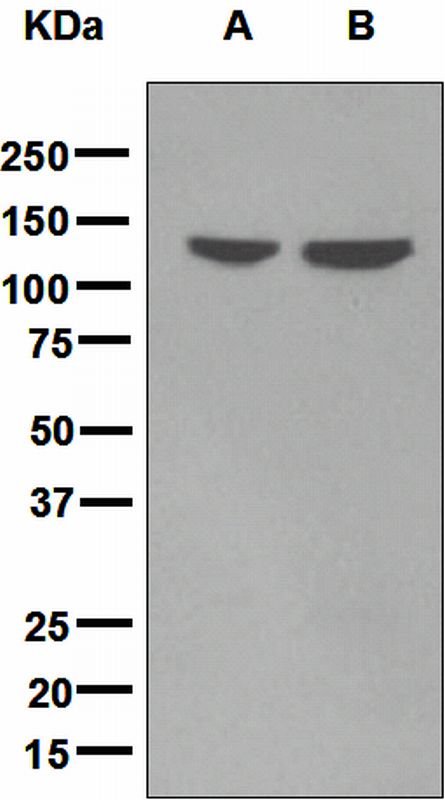 Western blot analysis on (A) human-small intestine and (B) colon cancer lysates using anti-LI-Cadherin antibody.