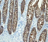 IHC of paraffin-embedded human colon tissue using anti-LI-cadherin antibody.