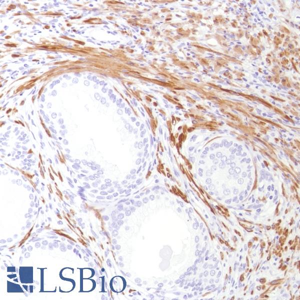 Immunohistochemistry of Human Prostate stained with anti-Calponin-1 antibody