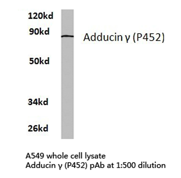 Western blot of Adducin (P452) pAb in extracts from A549 cells.