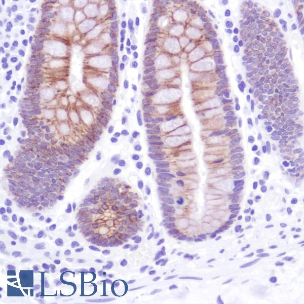 Immunohistochemistry of Human Colon stained with anti-Cadherin-17 antibody