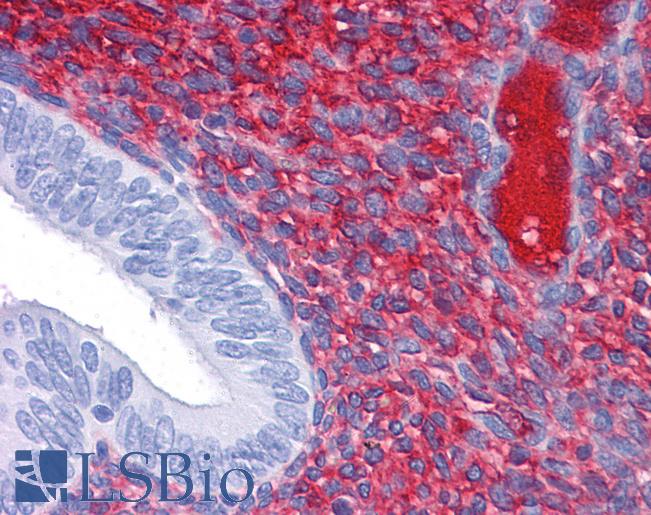 Anti-CDH18 antibody IHC of human uterus. Immunohistochemistry of formalin-fixed, paraffin-embedded tissue after heat-induced antigen retrieval. Antibody LS-B4298 concentration 5 ug/ml.
