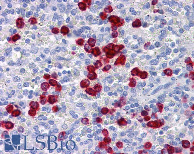 Anti-CDH18 antibody IHC of human spleen. Immunohistochemistry of formalin-fixed, paraffin-embedded tissue after heat-induced antigen retrieval. Antibody LS-B4298 concentration 5 ug/ml.