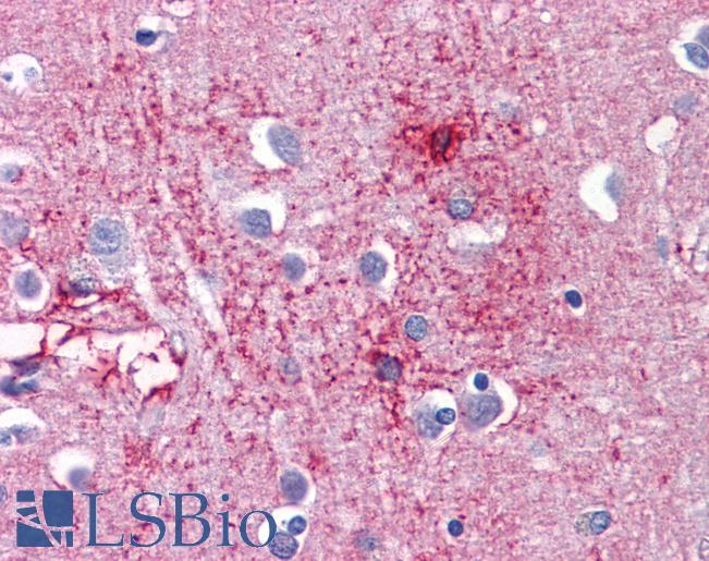 Anti-CDH18 antibody IHC of human brain, cortex. Immunohistochemistry of formalin-fixed, paraffin-embedded tissue after heat-induced antigen retrieval. Antibody LS-B4298 concentration 5 ug/ml.