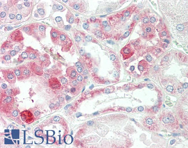 Anti-ADD3 antibody IHC staining of human kidney. Immunohistochemistry of formalin-fixed, paraffin-embedded tissue after heat-induced antigen retrieval. Antibody LS-B10008 concentration 10 ug/ml.