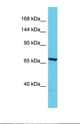 Western blot of Human Jurkat. ADGB antibody dilution 1.0 ug/ml.