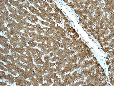 IHC of paraffin-embedded human liver tissue using anti-ADH1A/1B/1C antibody.