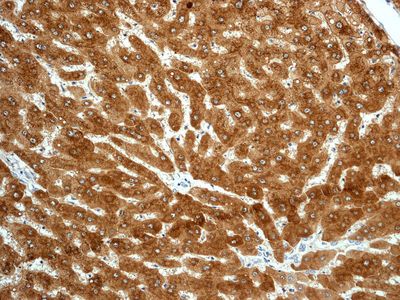 IHC of paraffin-embedded human liver tissue using anti-ADH1A/1B/1C antibody.