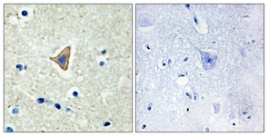 IHC of paraffin-embedded human brain tissue, using CDH20 Antibody. The picture on the right is treated with the synthesized peptide.