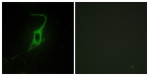 Immunofluorescence of NIH-3T3 cells, using CDH20 Antibody. The picture on the right is treated with the synthesized peptide.