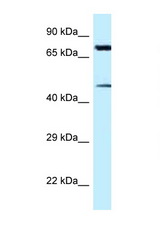 CDH22 antibody LS-C145808 Western blot of HeLa Cell lysate. Antibody concentration 1 ug/ml.