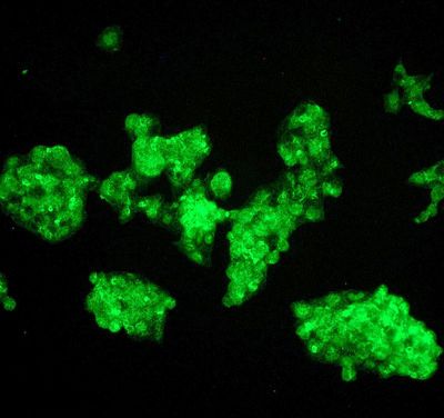 Immunofluorescent staining of HepG2 cells using anti- ADH1A/1B/1C antibody.