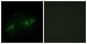 Immunofluorescence of NIH-3T3 cells, using CDH22 Antibody. The picture on the right is treated with the synthesized peptide.
