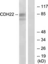 Western blot of extracts from rat brain cells, using CDH22 Antibody. The lane on the right is treated with the synthesized peptide.