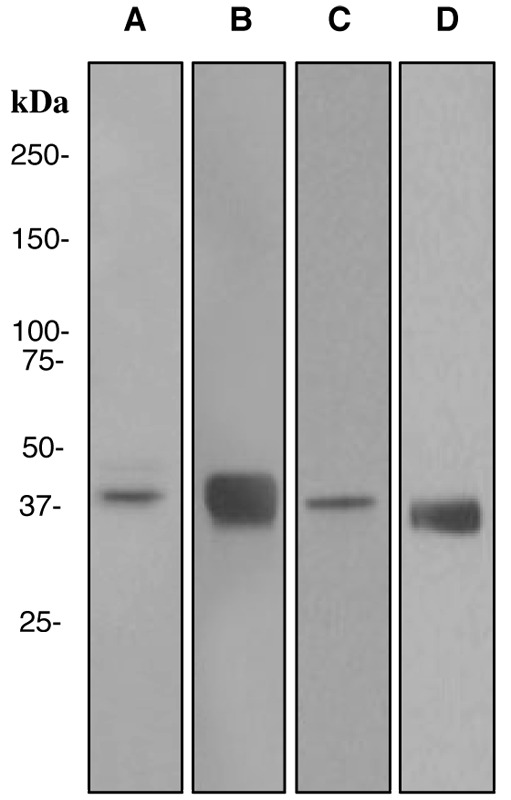 Western blot analysis on (A) HepG2, (B) mouse liver, (C) fetal liver, and (D) rat liver lysates using anti-ADH1A/1B/1C antibody.
