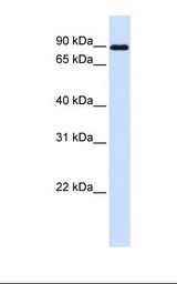 Placenta lysate. Antibody concentration: 1.0 ug/ml. Gel concentration: 12%.