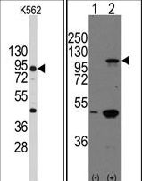 Western blot of anti-CDH3 Antibody in K562 cell line lysates (35 ug/lane). CDH3(arrow) was detected using the purified antibody. Western blot of CDH3 (arrow) using rabbit polyclonal CDH3 Antibody. 293 cell lysates (2 ug/lane) either nontransfected (Lane 1) or transiently transfected with the CDH3 gene (Lane 2) (Origene Technologies).