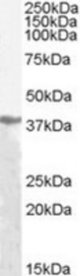 Antibody (1 ug/ml) staining of Human Liver lysate (35 ug protein/ml in RIPA buffer). Primary incubation was 1 hour. Detected by chemiluminescence.