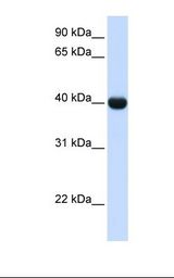 Fetal liver lysate. Antibody concentration: 1.0 ug/ml. Gel concentration: 12%.