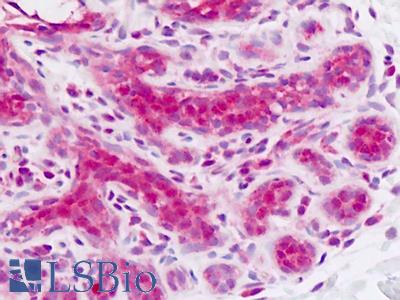 Human Breast: Formalin-Fixed, Paraffin-Embedded (FFPE)