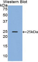 Western blot of recombinant ADH1A / Alcohol Dehydrogenase.