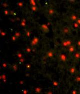 Immunofluorescence of CDH4 Antibody Antibody with paraffin-embedded human brain tissue. 0.025 mg/ml primary antibody was followed by FITC-conjugated goat anti-rabbit lgG (whole molecule). FITC emits green fluorescence.Red counterstaining is PI.
