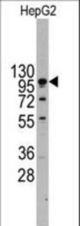 Western blot of anti-CDH4 Antibody (RB13654) in HepG2 cell line lysates (35 ug/lane). CDH4(arrow) was detected using the purified antibody.
