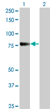 Western Blot analysis of CDH6 expression in transfected 293T cell line by CDH6 monoclonal antibody (M05), clone 2F2.Lane 1: CDH6 transfected lysate(73.9 KDa).Lane 2: Non-transfected lysate.