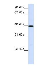 Fetal liver lysate. Antibody concentration: 1.0 ug/ml. Gel concentration: 12%.