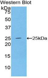 Western blot of recombinant ADH1A / Alcohol Dehydrogenase.